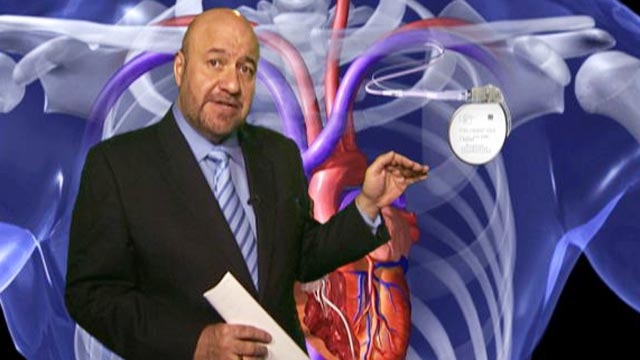 Heart Pacing Technology