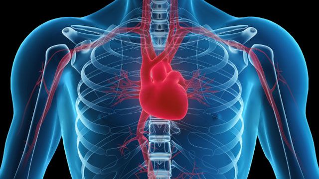 What is an enlarged heart?