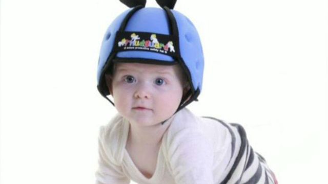 Are baby helmets the latest parenting accessory?
