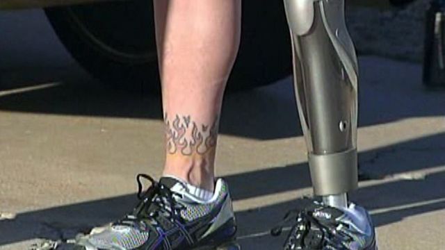 Oklahoma man has prosthetic leg stolen