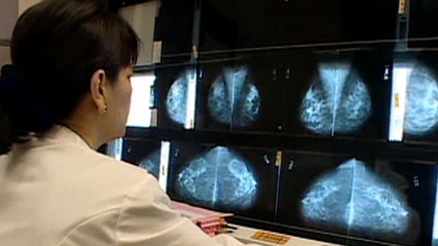 Blood Test May Detect Breast Cancer