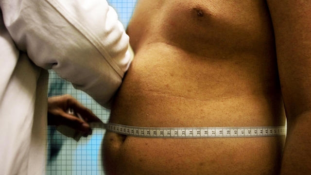 Are Overweight Americans Discriminated Against?