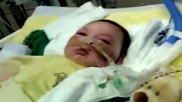 Doctors Operate on Baby Joseph