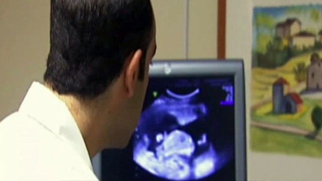 Georgia Senate to vote on restricting abortion