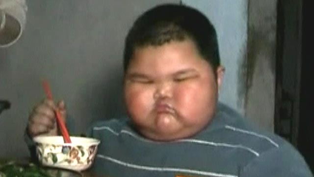 Obese 3-Year-Old Tips Scales at 132 Pounds