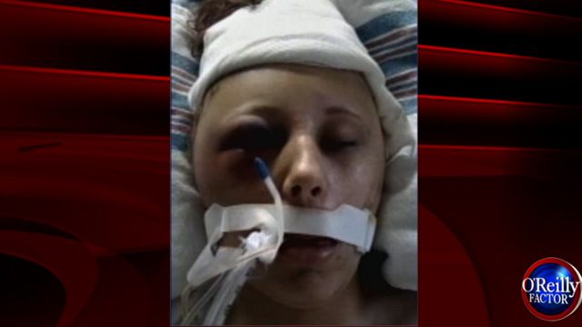 Girl in Coma Over Text Messages