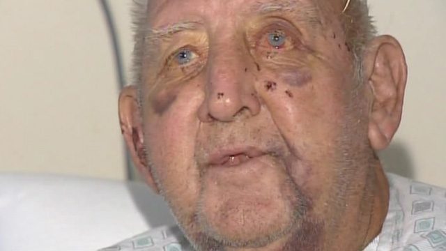Elderly Man Severely Beaten on Camera