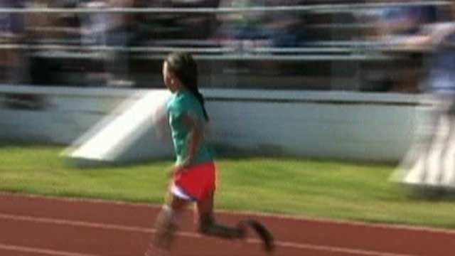 9-Year-Old Tries Out Her New 'Running' Legs