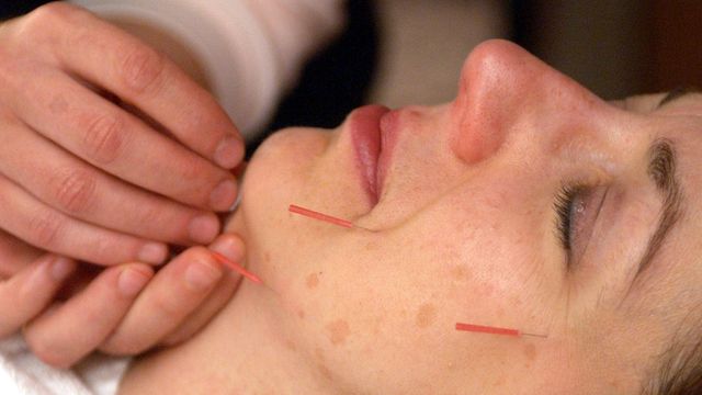 Acupuncture: Risks and benefits