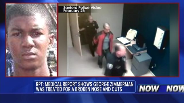 George Zimmerman's Injuries Detailed 