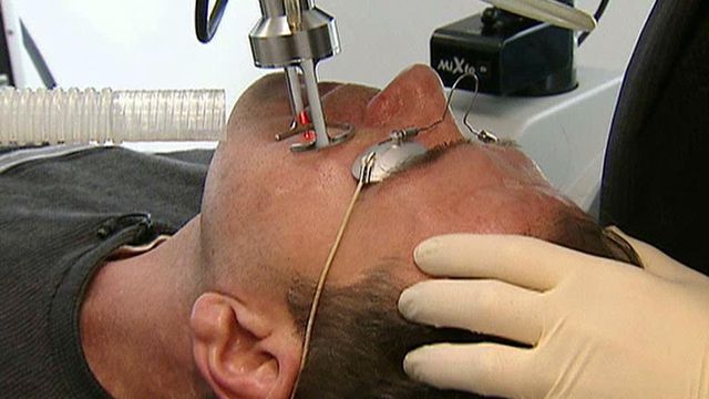 Non-invasive cosmetic procedures on the rise among men