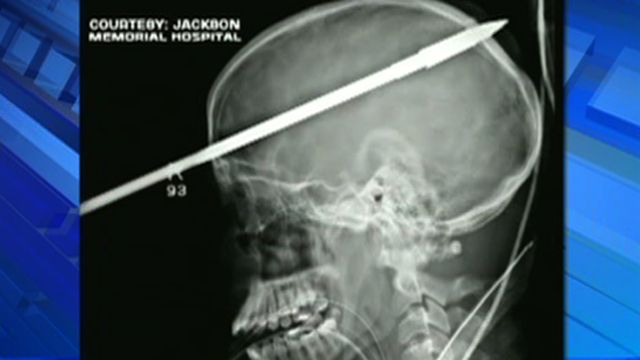 FL Teen Shot in Head With Speargun