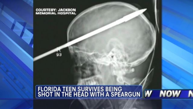 Florida Teen Survives Spear Through Head
