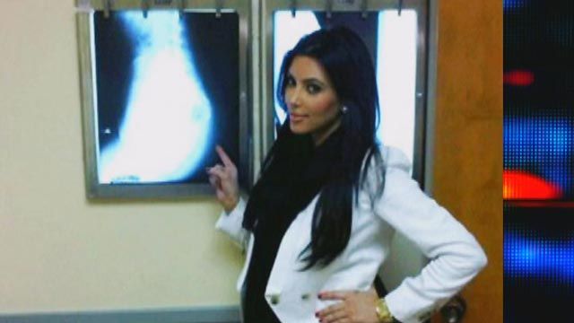 Oh No They Didn’t: Kim Kardashian X-rays Her Fanny?