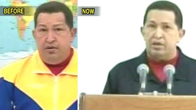 Chavez Reveals New Details on Health Problems