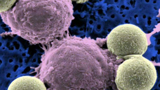 'Training' Cells to Kill Cancer?
