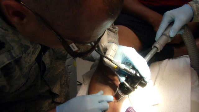 Laser treatment gives new hope to wounded warriors