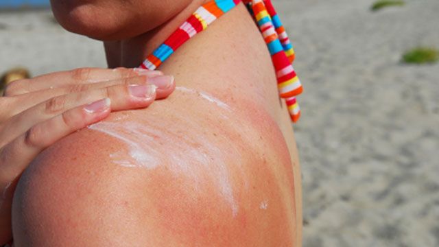 Fast fixes for summertime ailments