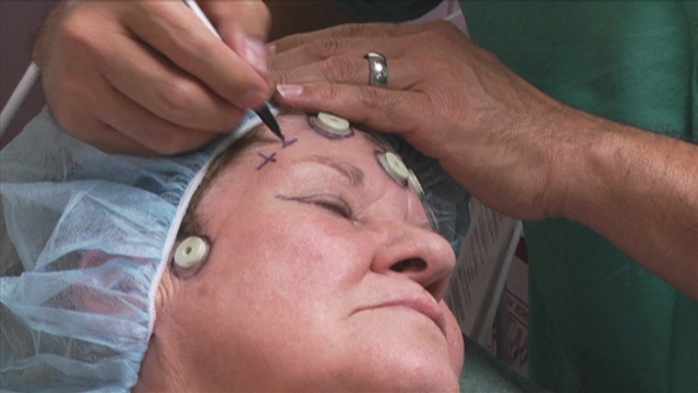 doctor, remove tumor through eyelid