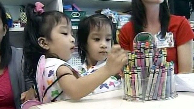 Conjoined Twins Prepare for Separation Surgery