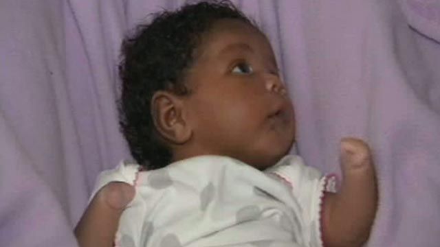 Uphill Battle for Baby Born with No Hands, Feet