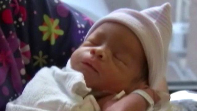 'Miracle' baby feared dead during delivery born alive