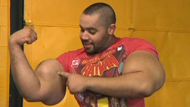 Real-life Popeye has world's largest arms
