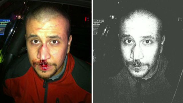 New photo shows Zimmerman with bloody nose night of shooting