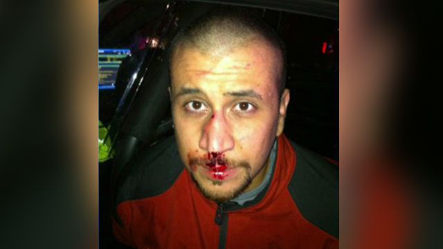 Image of bloodied Zimmerman on night of Trayvon Martin clash