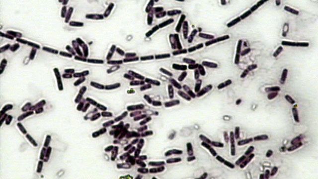 Bacteria in Food Prepared by Restaurant Makes Employees Sick